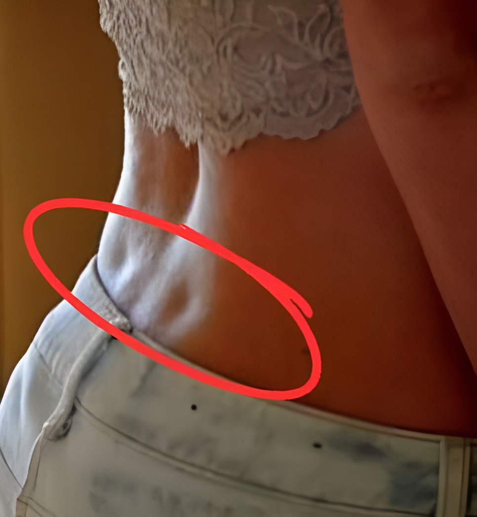 The Tiny Indentations On The Decreased Again Usually Known As dimples The Tiny Indentations On The Decreased Again Usually Known As dimples